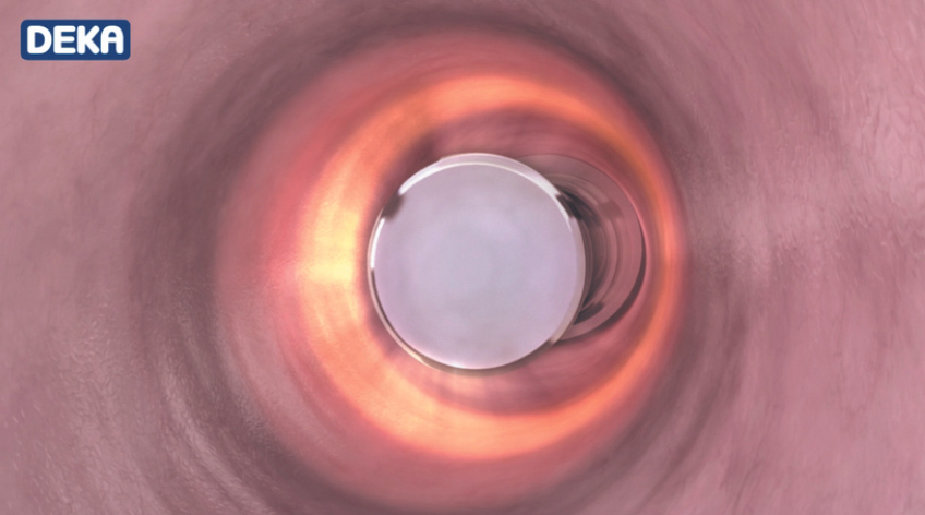 lisa2.png