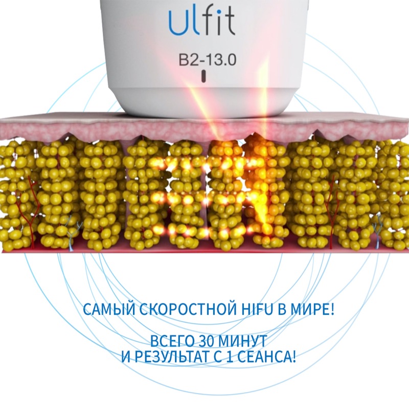 ulfit_123_2.jpg